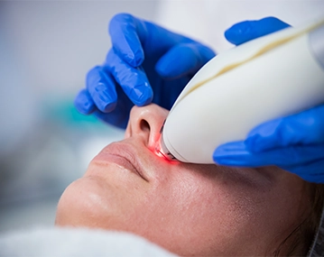 Indian woman receiving laser pigmentation treatment